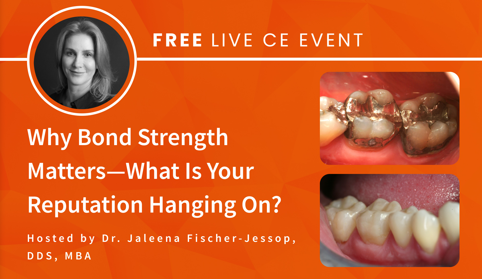 unlock-the-mysteries-of-bond-strength-in-advanced-restorative-dentistry